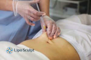Does Skin Sag After Fat Dissolving Injections? 2 Do you want to get Aqualyx fat dissolving injections Market Bosworth but worried about loose skin afterwards?