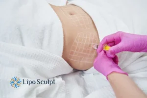 Are The Results From Aqualyx Permanent? 1 Do you want to know how long Aqualyx Market Bosworth results last?