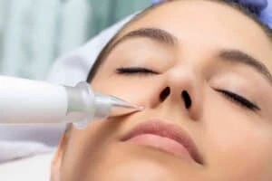 Best Actinic Keratoses Removal 3 Actinic keratoses Market Bosworth solutions - book in today!